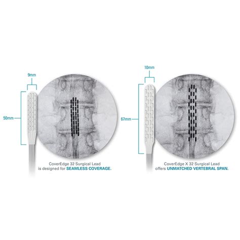 boston scientific lv lead|Boston Scientific coveredge paddle lead.